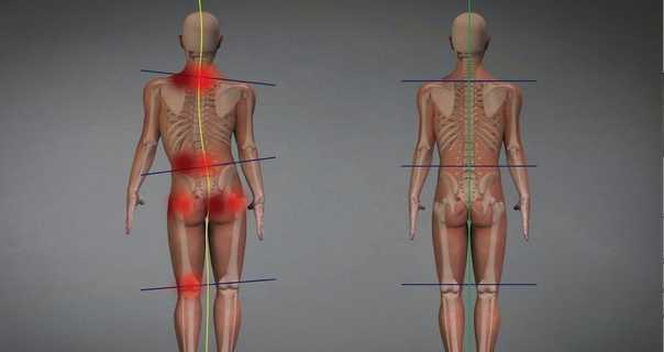 Артроз суставов: лечение, симптомы. степени артроза.