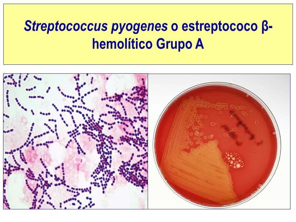 стрептококк присутствует в... Отдельная группа инфекционных заболеваний, пр...