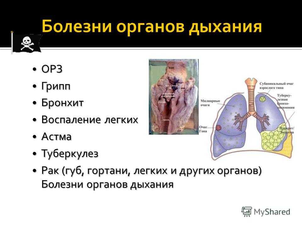Инфекционная пневмония. крысы