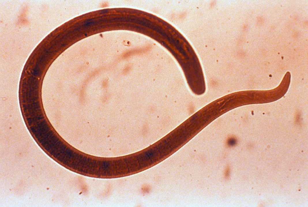 Обнаружение ленточного червя в человеке, симптоматика заражения паразитами