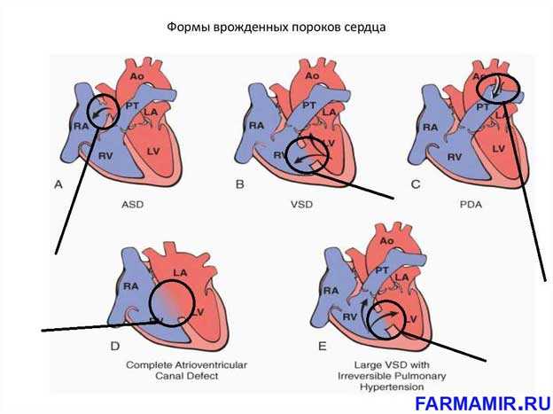 ᐉ врожденные патологии сердца у кошки - ➡ motildazoo.ru