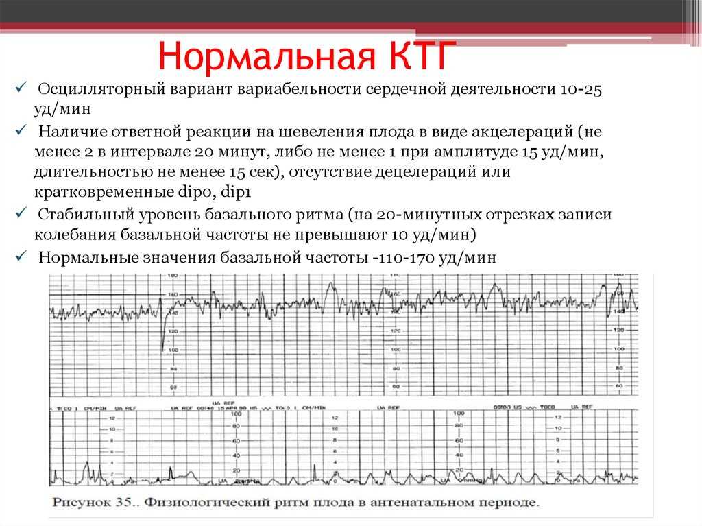 Артериальное давление – норма и патология | www.mgb1-74.ru