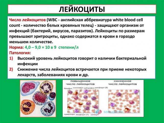Лейкопения: лейкоциты при онкологии – сколько должно быть, уровень лейкоцитов при раке, показатели | клиники «евроонко»