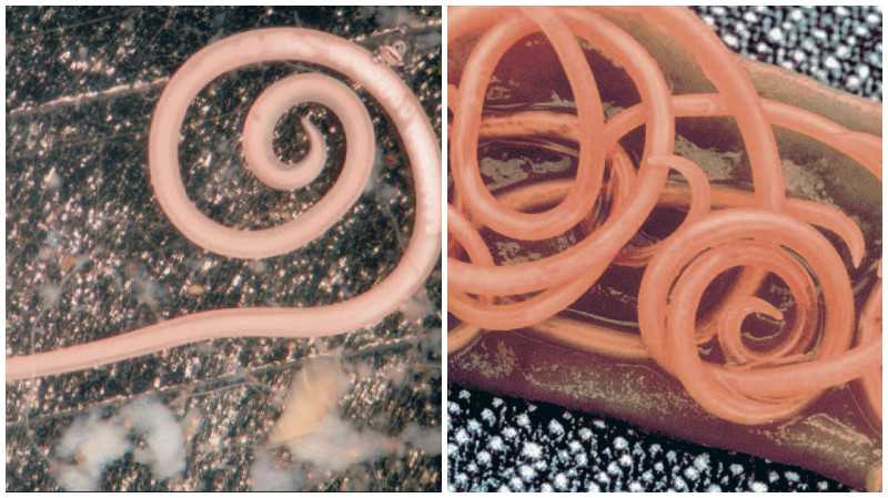 Ленточный червь в человеке – строение гельминтов, клинические проявления