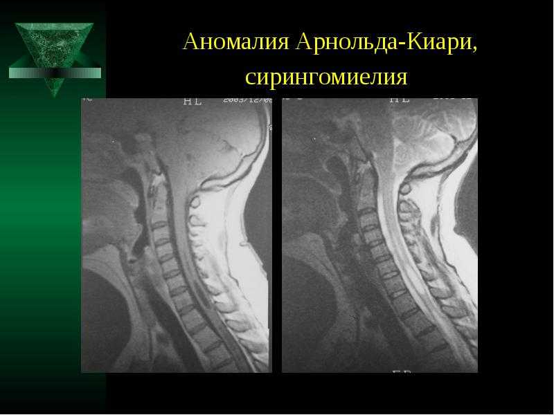Повреждения нервов верхних и нижних конечностей (периферических нервов) | москва