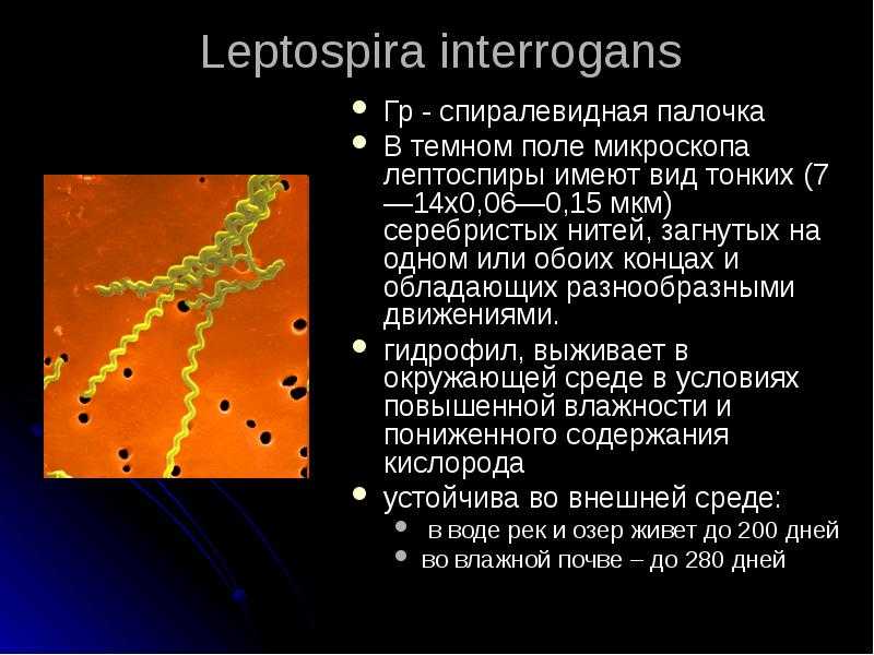 Лептоспироз - симптомы болезни, профилактика и лечение лептоспироза, причины заболевания и его диагностика на eurolab