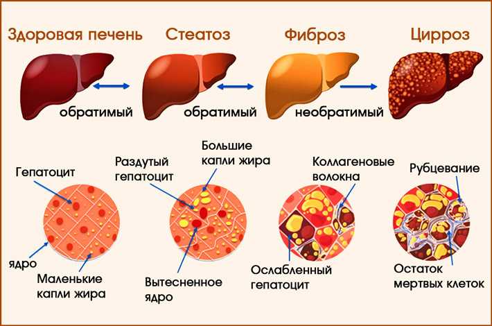 Лечение печени у кошек - диагностика заболеваний печени у кошек в москве.  ветеринарная клиника "зоостатус"