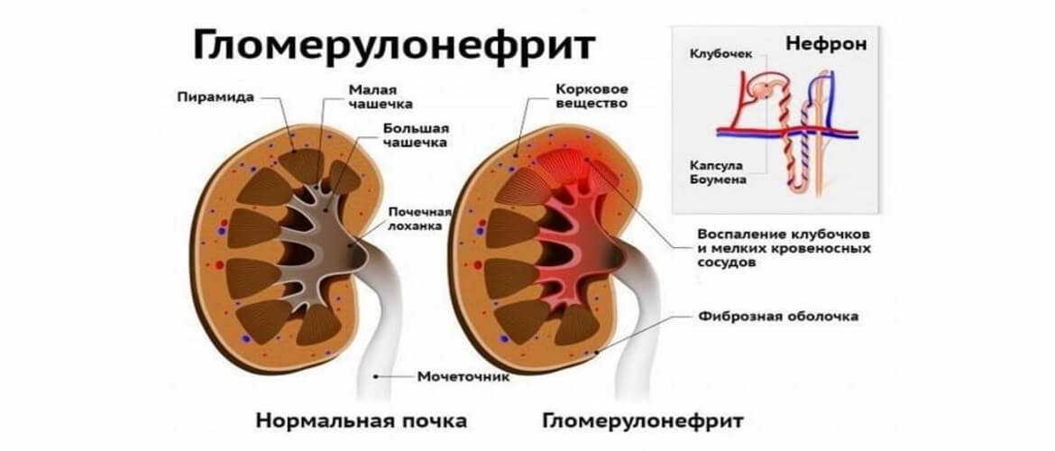 Камни в почках у кошек  - симптомы, лечение нефролитиаза кошек в москве. ветеринарная клиника "зоостатус"
